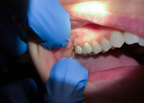 Dentist for Dental Trauma in OR