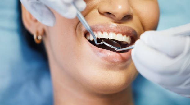 Best Emergency Dental Filling Replacement  in Salem, OR